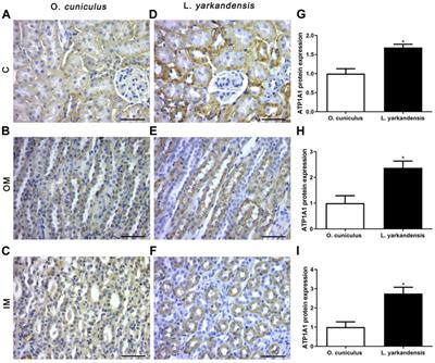 Expression Regulation of Water Reabsorption Genes and Transcription Factors in the Kidneys of Lepus yarkandensis